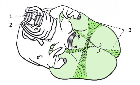 Illustration 3
